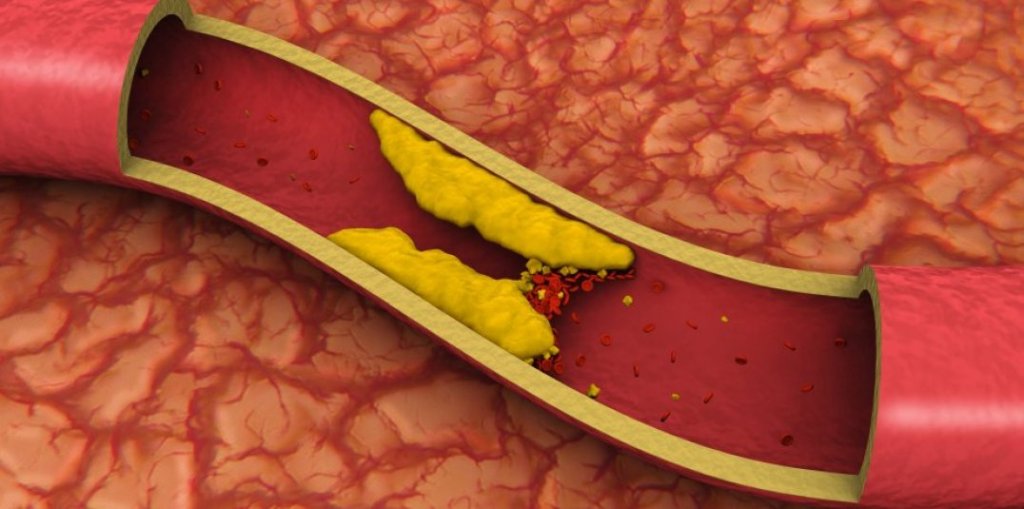 O bom funcionamento da tireoide garante a redução do colesterol ruim (LDL) e a elevação do colesterol bom (HDL). Coma normalização da taxa de colesterol no sangue, reduz-se o perigo de doenças cardiovasculares.