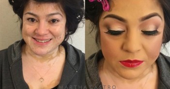 5 transformações de pessoas com vitiligo que comprovam o poder da maquiagem
