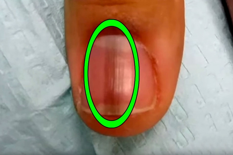 O que os meios ajudam de lugares de pigmentary
