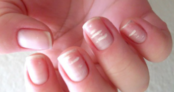 como tirar as manchas brancas das unhas